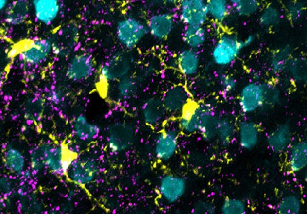 Awakening the brain